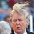 Toupee or Not Toupee? That is the Question: But What’s the Answer?